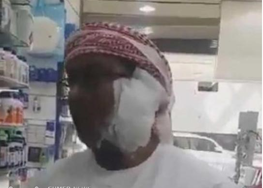 آيفون 8 ينفجر في وجه مواطن خليجي