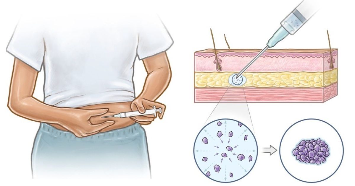 It can be used to prevent pregnancy. Creating one injection whose effect lasts years