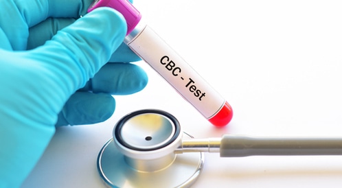 Blood -Supply Investigation: How to perform the investigation and analysis of the results