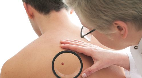 Watch the video: How to form skin cancer