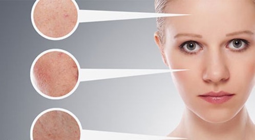 A video outline of the general causes of rash