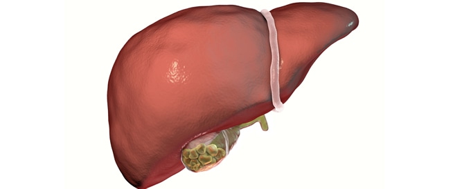 Gallstones: causes, symptoms and treatment