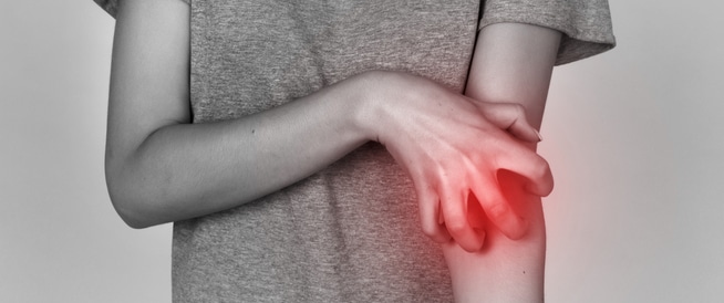 Scab: causes, symptoms and treatment