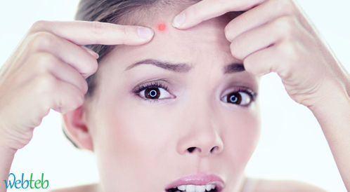 Video: Prevention of Acne