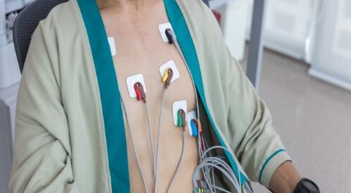 Electric Heart Planning: Method of guidance and an analysis of the results