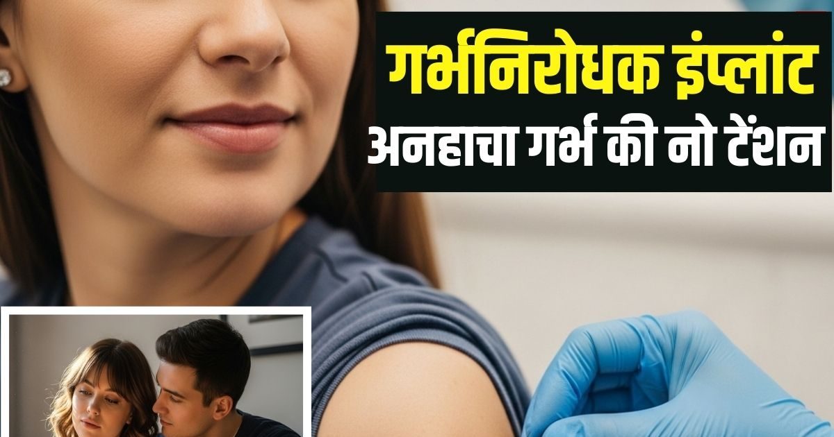 None of the condom need to be taken, it will be implanted near the forearm, this stick will not happen