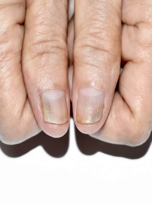 These 5 signs of a major illness